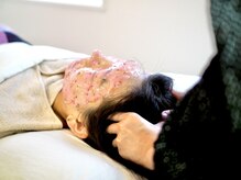 モア30(more30)/【施術風景】ドライヘッドスパ