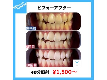 ホワイトニングショップ 京都駅前店/【提携監修の溶剤使用】