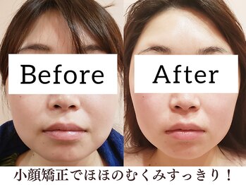 シエル(Siele)/パワーストーンを使った小顔矯正