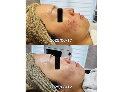 ルーク(Luke)の写真