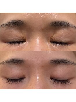 ルソール(Le seul)の写真/【SNSで話題沸騰中】医療提携サロンだから入手可能なヒト幹細胞原液導入で肌トラブル徹底改善！