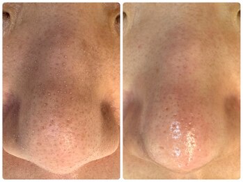 サイセイ(SAISEI)/