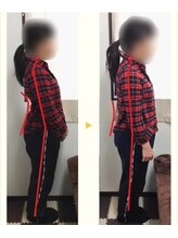 フィール整体院【肩こり/腰痛/骨盤矯正】/姿勢や反り腰も改善！