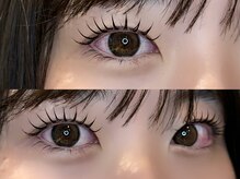 キュロン(quro.n)/&healthy ×W flatlash