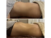 ビンナ 五反田店(Binna)/腸もみ