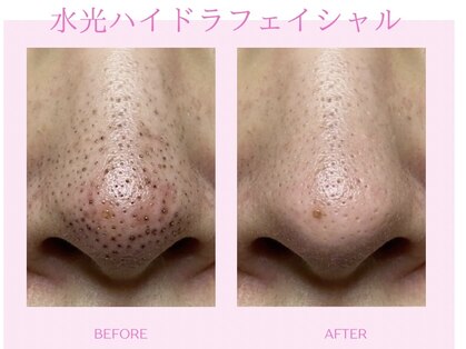 バービーフェイス 恵比寿(Barbie Face)の写真