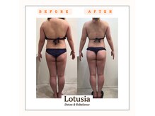 ルトゥーシア(Lotusia)の雰囲気（全身痩身before→after）