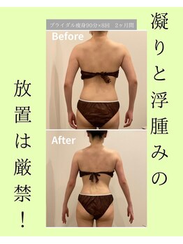 メゾンワン(maison one)/差がつくのは背中と二の腕