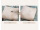 ディーエムピーコネクト(dmp connect)の写真/完全個室!清潔感のあるツルすべ肌で清潔感をグッとUP!ヒゲ剃りが面倒な方、カミソリ負けで肌荒れする方も◎