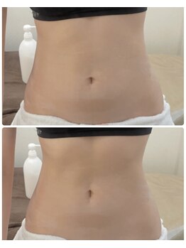 オプレア 千種店(OPREA)/【比較写真】ハイパーナイフ効果