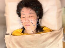 こじま 富雄団地接骨院/美容鍼