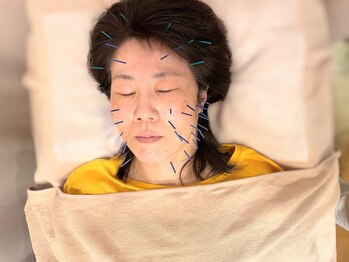 こじま 富雄団地接骨院/美容鍼