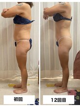 ビューティーショップ リアン(RIAN)/ムクミケア♪