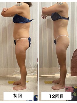 ビューティーショップ リアン(RIAN)/ムクミケア♪