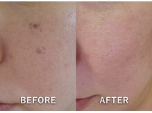 ルコア ドゥ(rucor doux)/シミアプローチしたい方◎