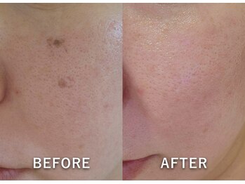 ルコア ドゥ(rucor doux)/シミアプローチしたい方◎