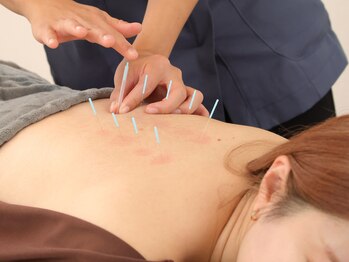 リム(Rim.)/鍼灸施術