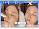 アリュール(ALLURE)の写真