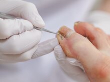 おん/爪ケアの流れ１