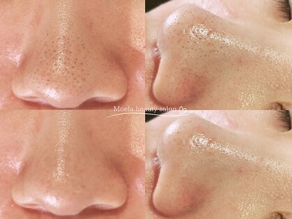 モエラビューティーサロン(Moela beauty salon)の写真