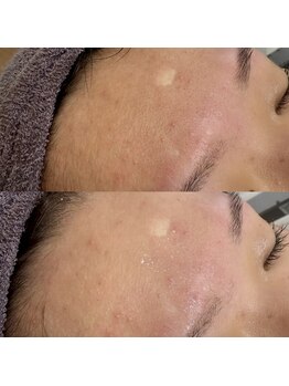 ビーズアモール 大府店(B's amor)/B’s amor 大府店 facial