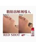 【2回目以降】RED SHOT脂肪分解で理想のフェイスラインを手に入れる★