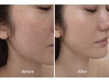 ルージュ(CP Rouge)/30代女性/オーダーメイド半年