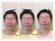 ローズ ド ナチュール(Rose de Nature)の雰囲気（美容整骨矯正　全身～小顔セット　経過写真）