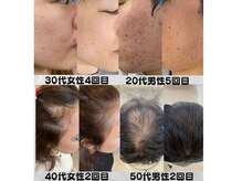 ルアナ(Ruana)の雰囲気(本気の頭皮&肌質改善【プロセル導入】生え続ける究極の育毛ケア)