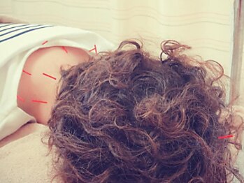 真奈美鍼灸整骨院の写真/部分的なだるさや疲労を改善したい方に◎熟練のオーナーによる施術で痛みやつらさの原因から徹底改善！