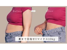 ラローゼ トウキョウ(LA ROSEE TOKYO)の雰囲気（クビレも美脚もまとめて叶う、夏痩身革命今からでも間に合う！）
