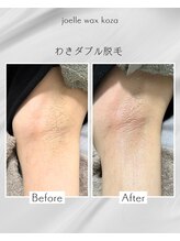 ジョエルワックス 沖縄コザ店(JOELLE WAX)/わきダブル脱毛☆