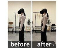 カワル整体 長嶺院/猫背　巻肩