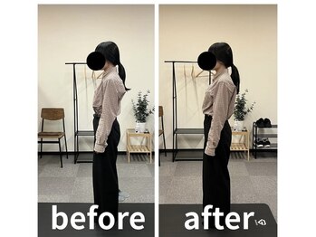 カワル整体 長嶺院/猫背　巻肩