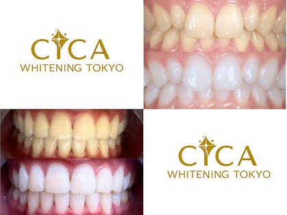 シカホワイトニングトウキョウ 笹塚店(CICA Whitening Tokyo)の写真