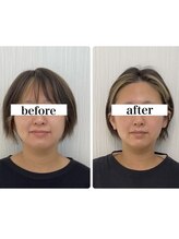 キュープ 松戸店(Qpu)/小顔頭蓋骨矯正