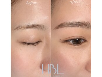 シエル(ciel)/ビフォーアフター