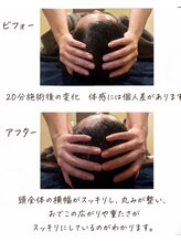 カナウ睡眠頭皮研究ラボ【7/3 NEW OPEN（予定）】&nbsp;頭蓋骨 筋膜剥がし