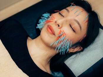 くすの樹接骨院 整体院 吉野ヶ里院/[美容鍼/鍼灸]リフトアップ/小顔