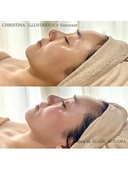 サロン ド ブラン アオヤマ(Salon de BLANC AOYAMA)/クリスティーナイラストリアス