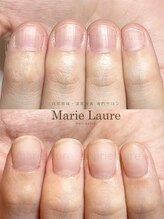 マリーロール 淀屋橋本店(Marie Laure)/自爪育成/深爪矯正/ネイルケア
