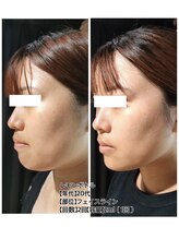 クレビア 神保町 水道橋(CREBIA)/レモンボトル