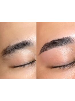 メンズフェイシャル