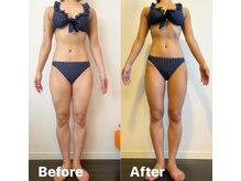 レナトゥス 銀座(Renatus)の雰囲気(【集中美脚ケア】1ヶ月でむくみ&セル肉解消!ほっそり美脚に♪)