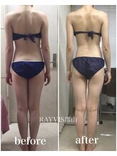 レイビス 郡山店(RAYVIS)/1度で激変！美整リンパマジック