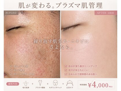 ベルエス(bell.s)の写真