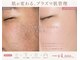 ベルエス(bell.s)の写真