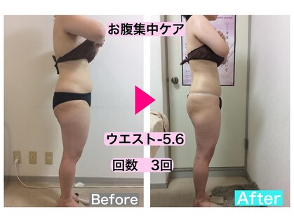 マッチ(much)の写真