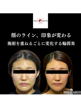 オアシス トウキョウ 川崎店(OASIS TOKYO)/美作矯正×サボテン美容鍼