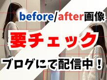 栄光治院 岡崎南院/before/after公開中！